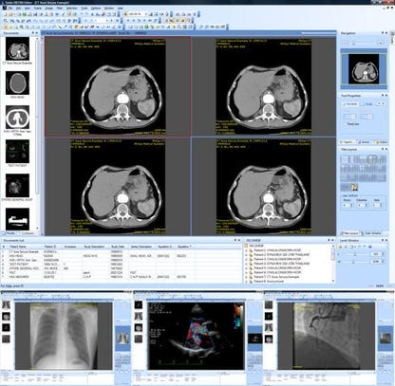 Sante DICOM Editor Key генератор